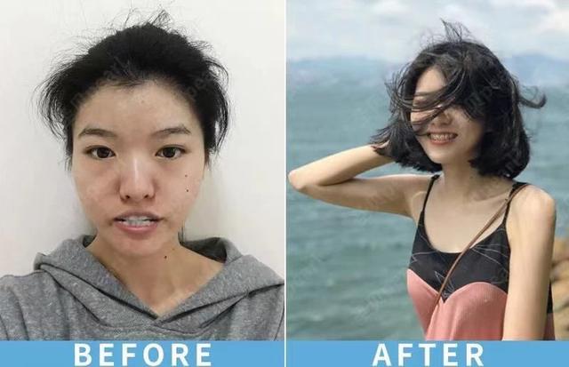 我俩戴牙套!而且在吧! 第6张