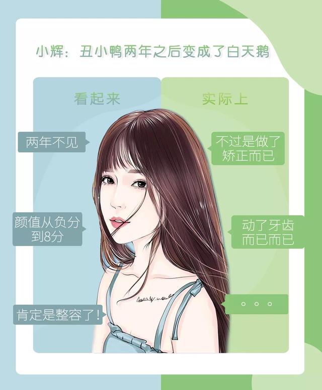 我俩戴牙套!而且在吧! 第5张
