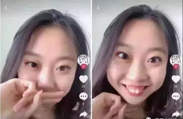 我俩戴牙套!而且在吧! 第11张
