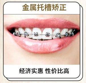 我俩戴牙套!而且在吧! 第43张