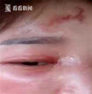女子找工作遭打拒绝提供性感照片被“雇主”约出报复 第3张
