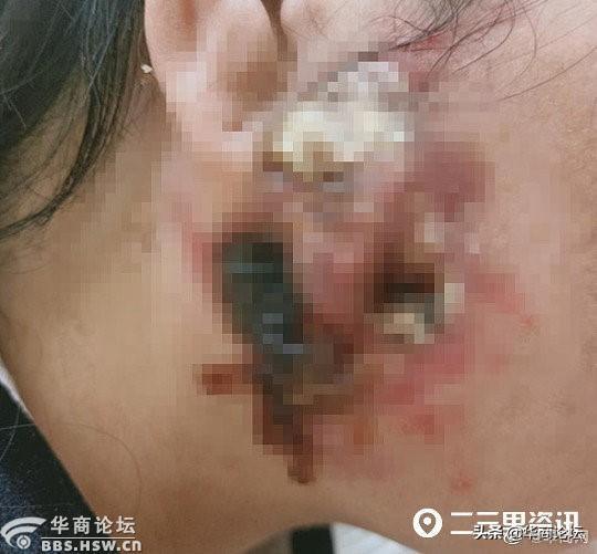 西安一大楼藏10家美容机构,涉嫌妨检公务 第9张