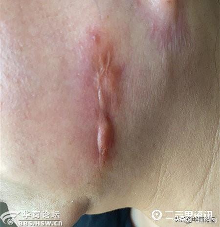 西安一大楼藏10家美容机构,涉嫌妨检公务 第10张