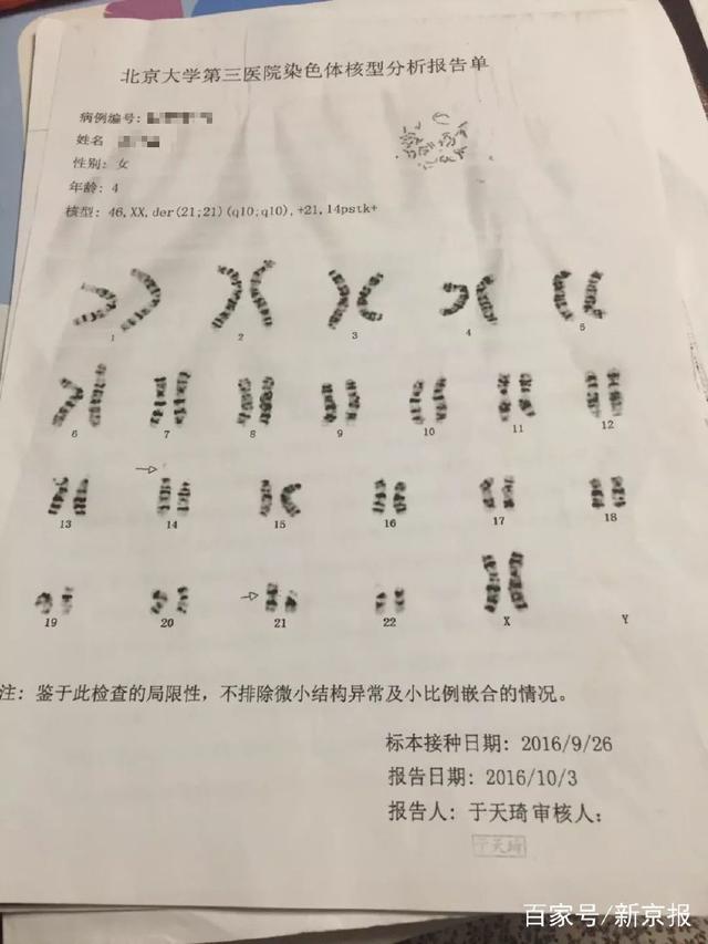无创基因检测产妇生出来仍是唐氏儿▲ 第2张